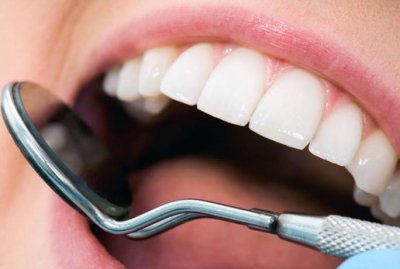 Реставрационное отбеливание зубов в Стоматологии "Бюро 32"