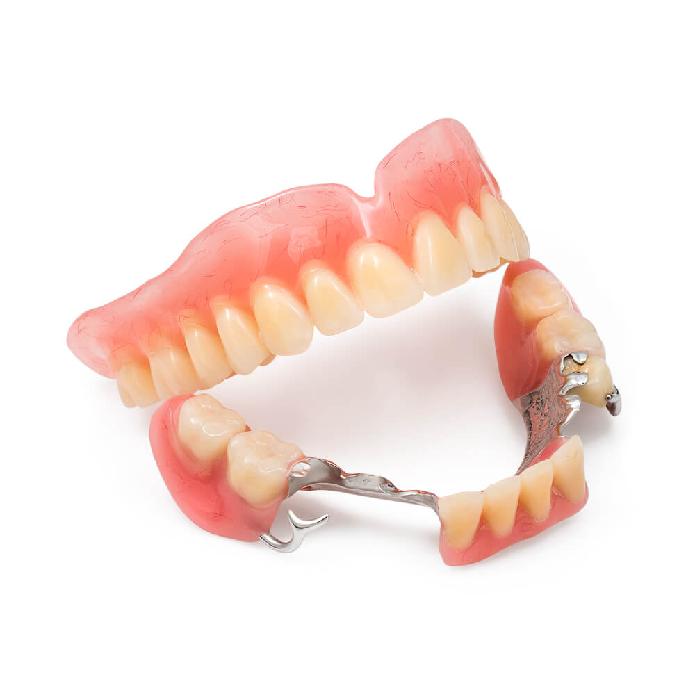 Протезирование зубов верхней челюсти в Стоматологии "Бюро 32"
