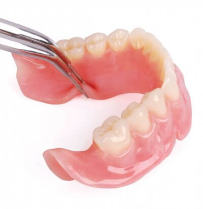 Под съемным зубным протезированием понимается замена отсутствующих зубов при помощи протезов, которые пациент может сам легко надевать и снимать. Чаще всего их используют, когда нет возможности поставить мостовидные протезы или лечить зубы при помощи имплантации. 