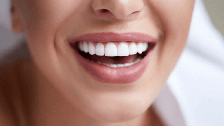 Отбеливание эмали зубов в Стоматологии Бюро 32