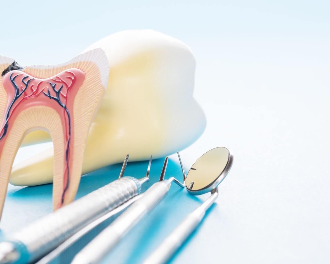 Лечение и удаление кисты на корне зуба в Стоматологии Бюро 32
