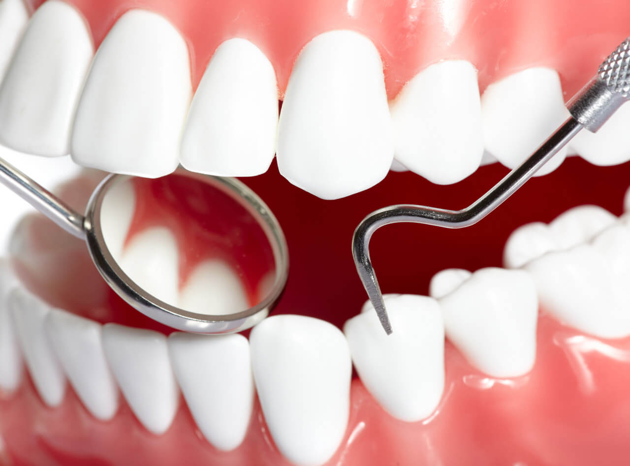 Лечение и удаление радикулярной кисты зуба в Стоматологии Бюро 32