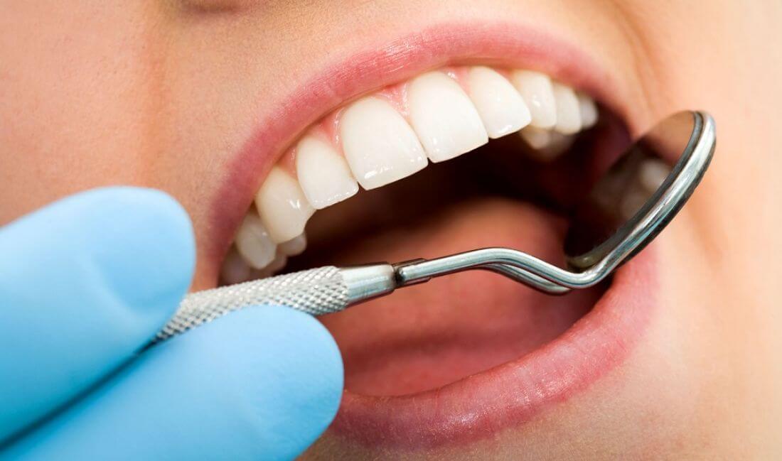 Удаление кисты зуба в Стоматологии Бюро 32